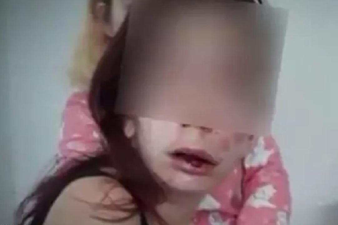 智障女孩遭3少女围殴 被逼吃玻璃