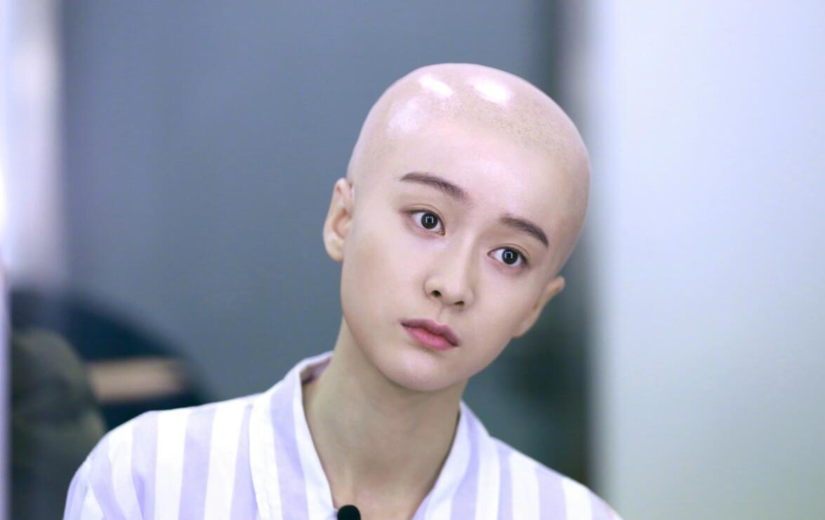 张雪迎挑战光头造型 化身癌症患者演技获赞