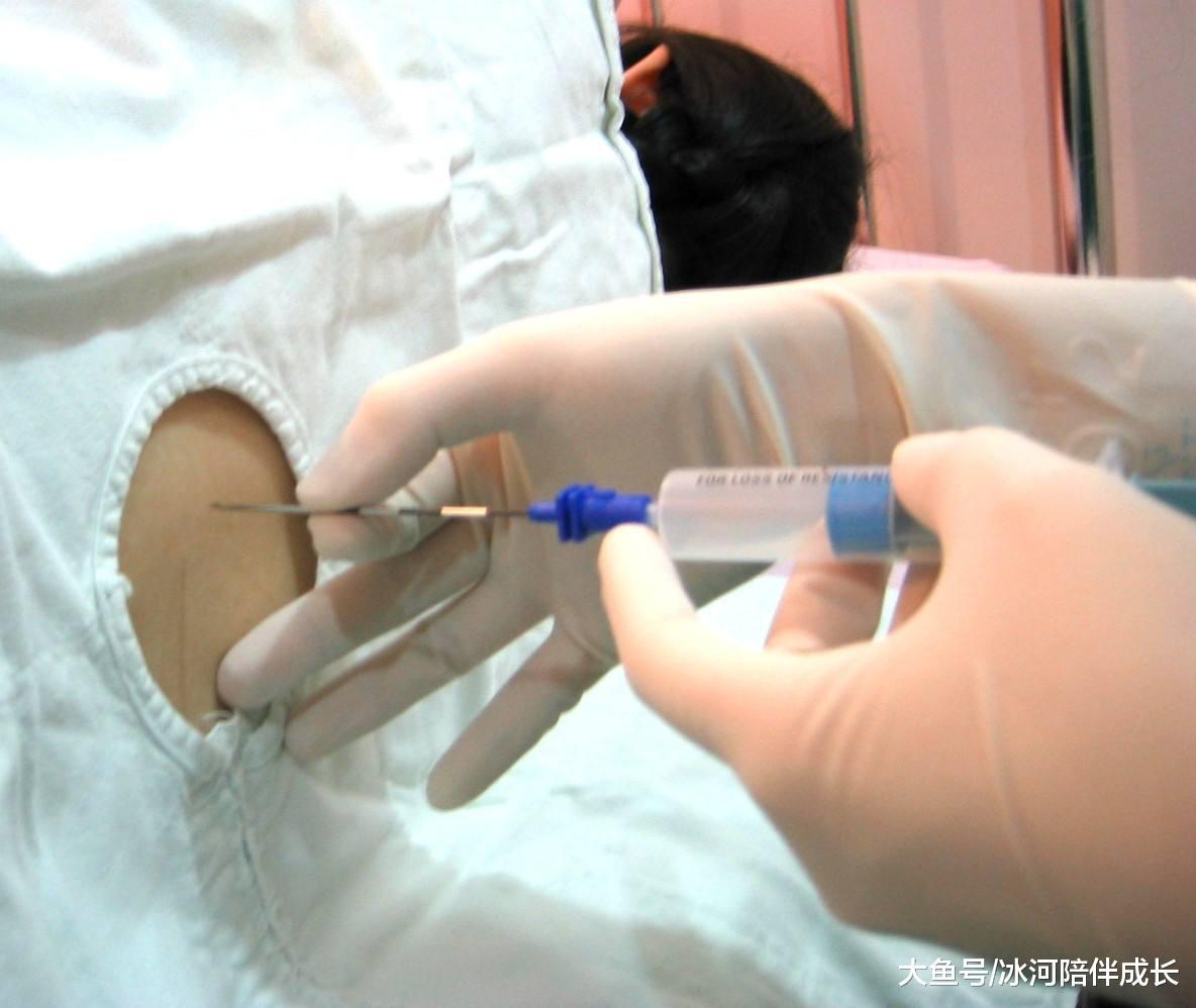 剖腹产选择局麻还是全麻孕妈先了解这两个的好坏