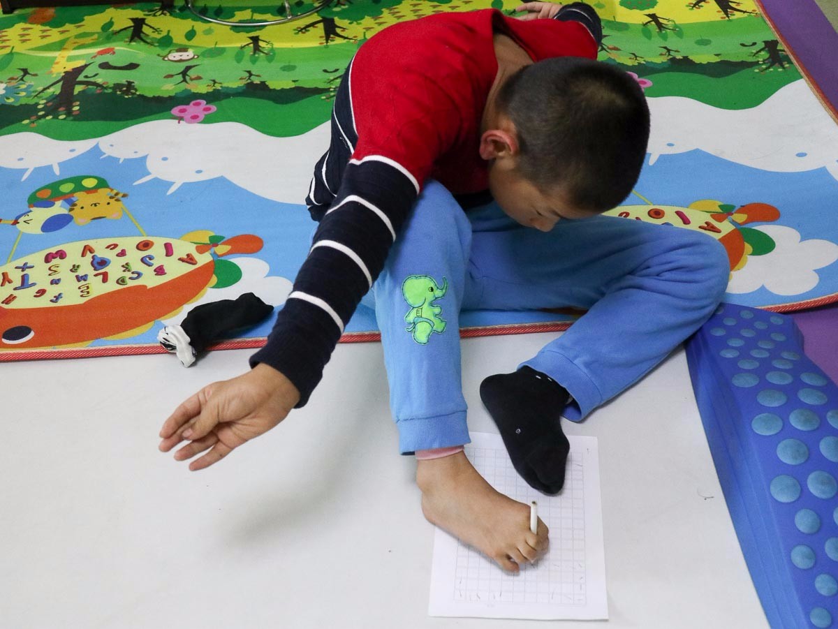 十年求医换来45秒站立行走 如今却因6万元面临中断治疗