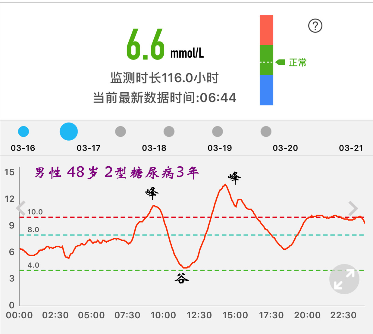 糖尿病人巧分餐,