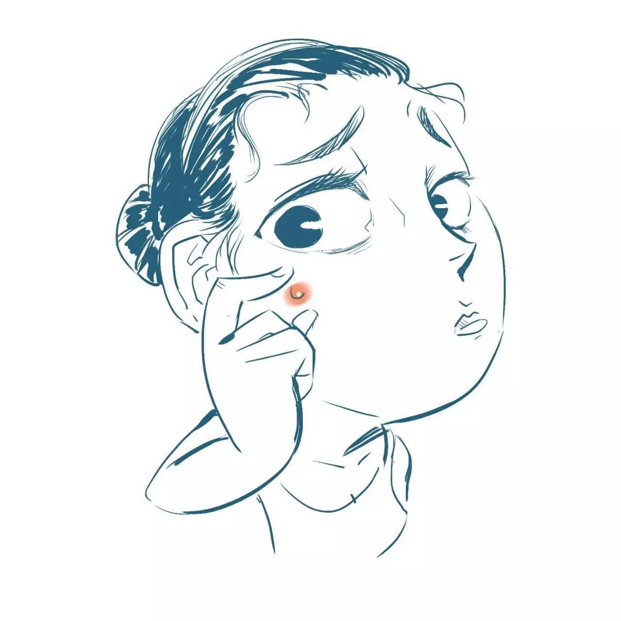 痘痘是怎么形成的,哪些不良习惯可能导致长痘