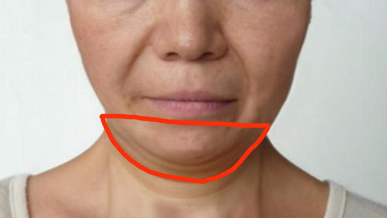 发胖总是先胖脸?脸部皮肤还松弛,下垂,答案你不会想到