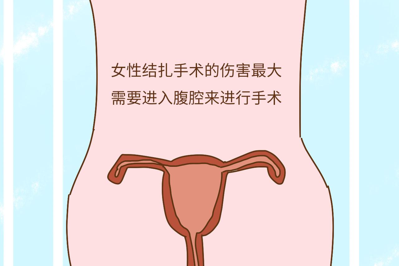 有孩子后,为什么越来越多的男性结扎?看完你就明白了