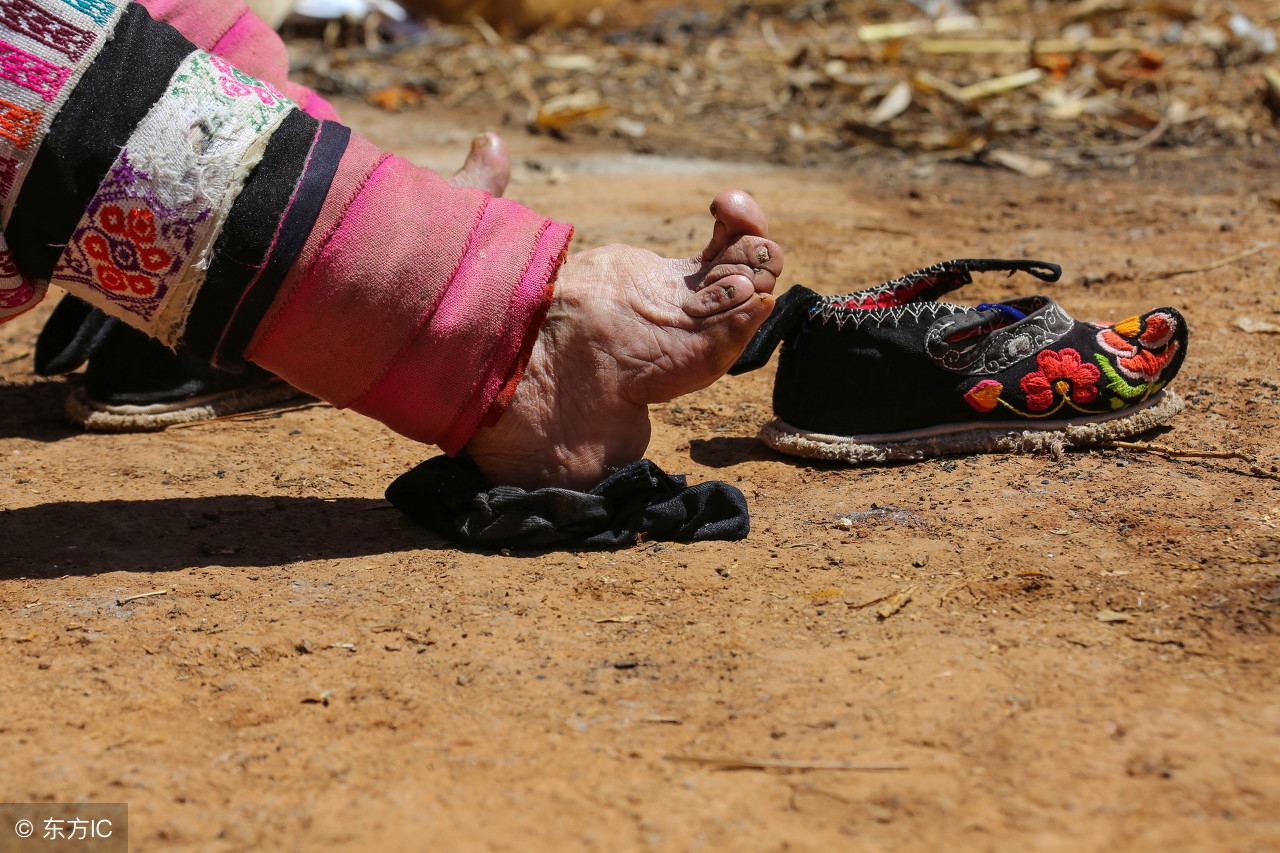 贵州87岁缠足老人,解开裹脚布看着都疼,三寸金莲让她痛苦了87年