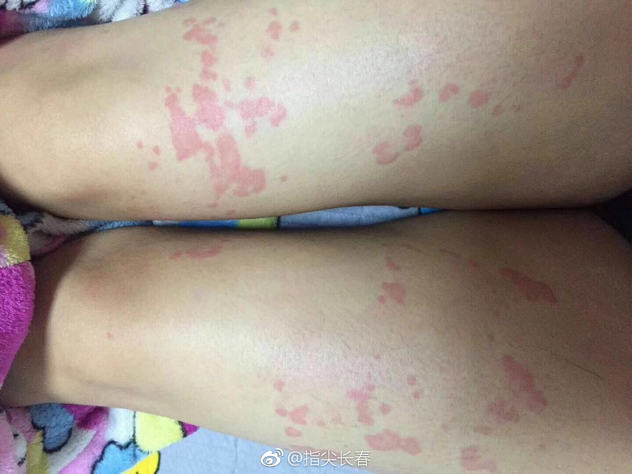 怀疑甲醛中毒,学生冬季开窗散味儿