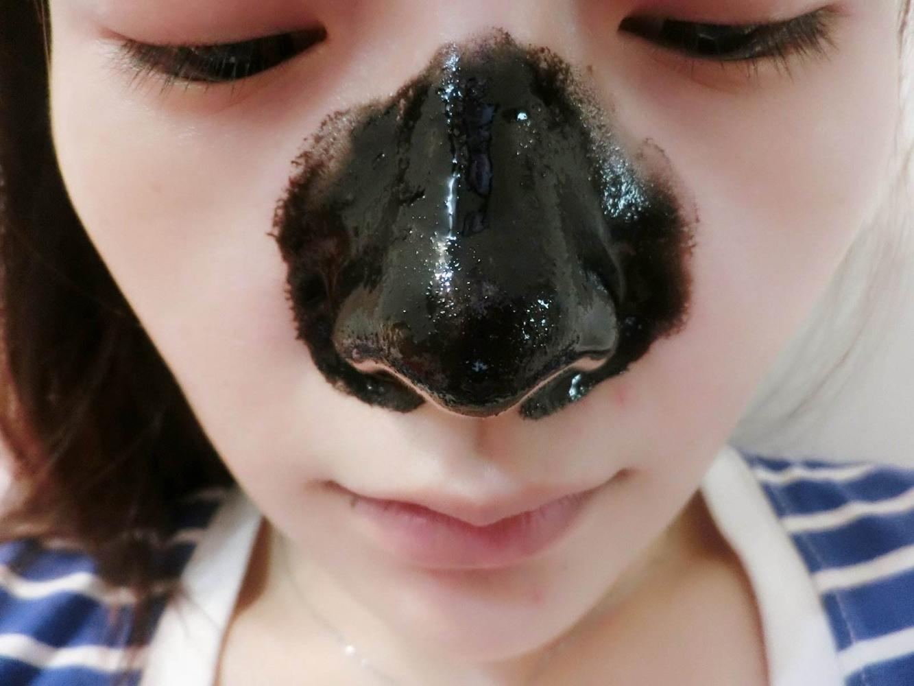 这样"去黑头" 效果明显100倍!