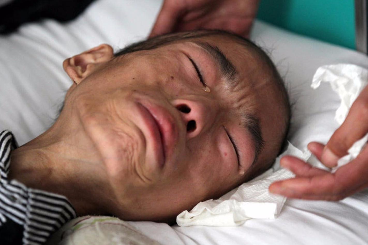 如果接受了癌症病人捐献的器官,身体会发生什么变化?