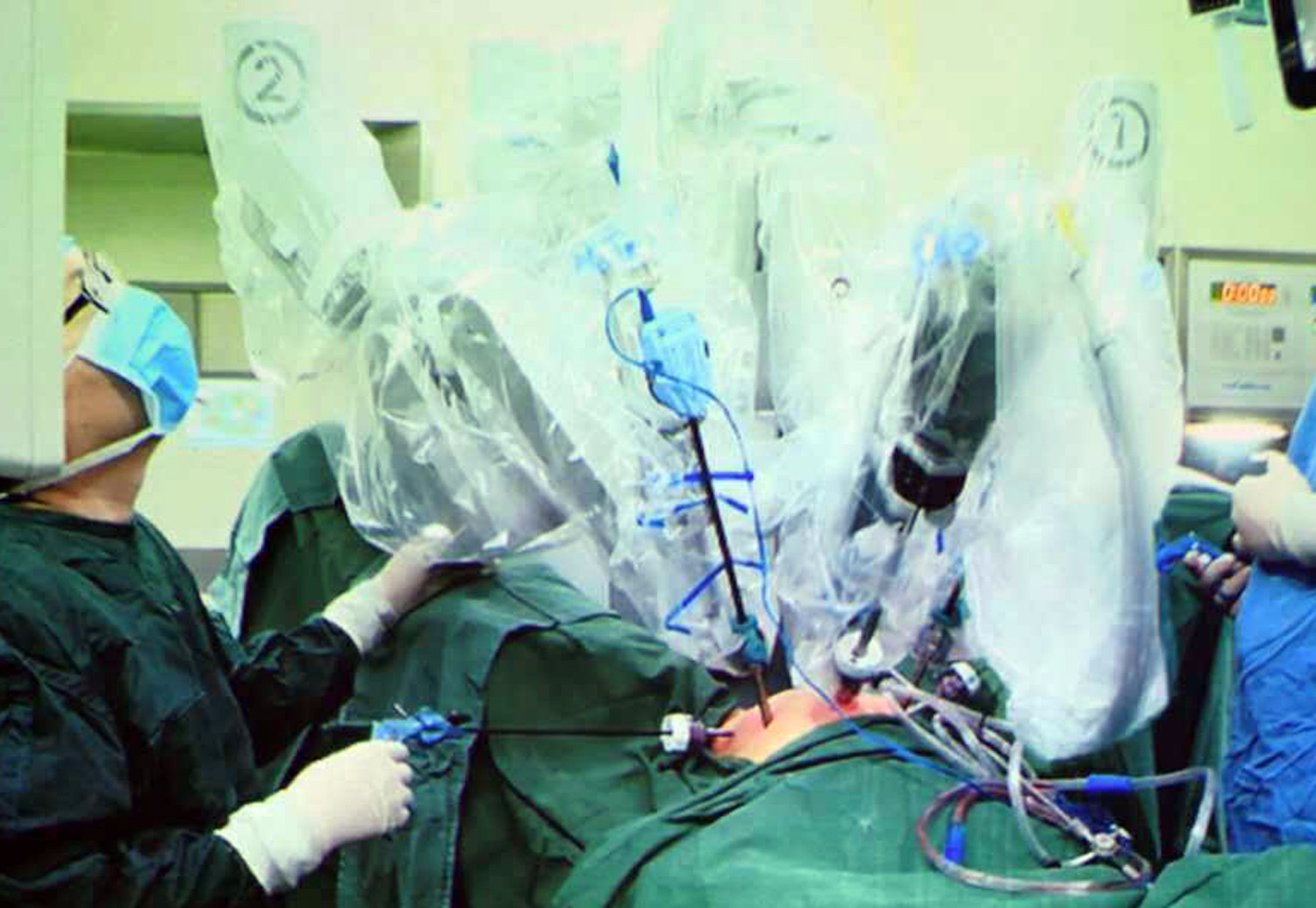 23岁"石女",用小肠移植手术重塑女儿身