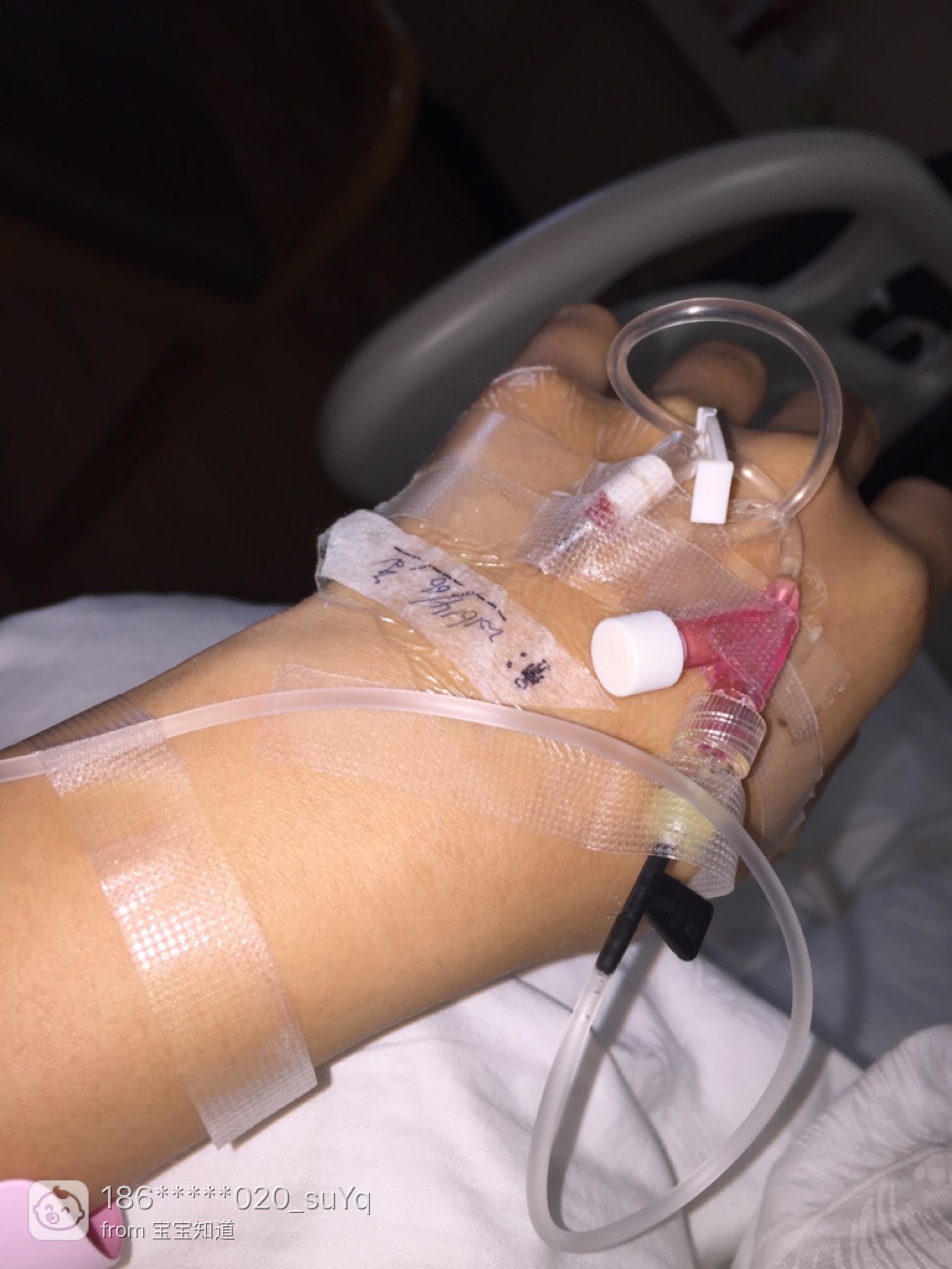 我为保胎打了60多针,怀孕5个月三维,医生说孩子有问题,要引产