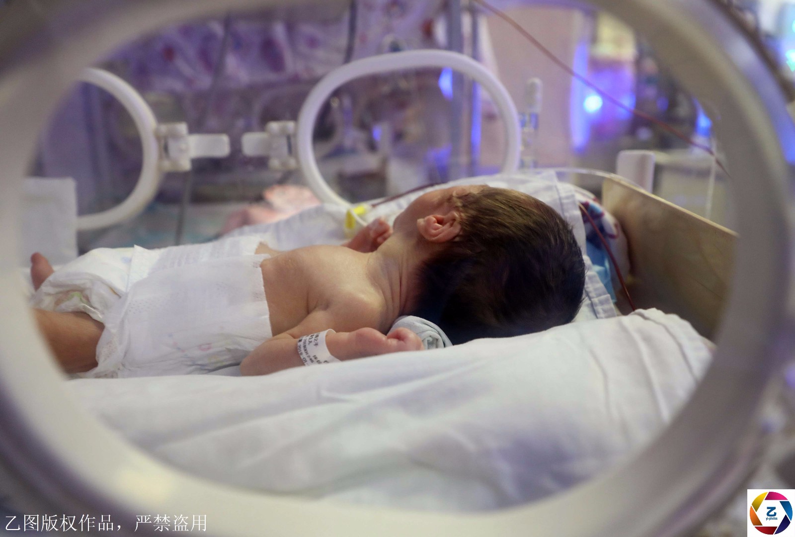 罕见,产妇生双胞胎,大双早产夭折,小双相隔13天后平安降生_新浪看点