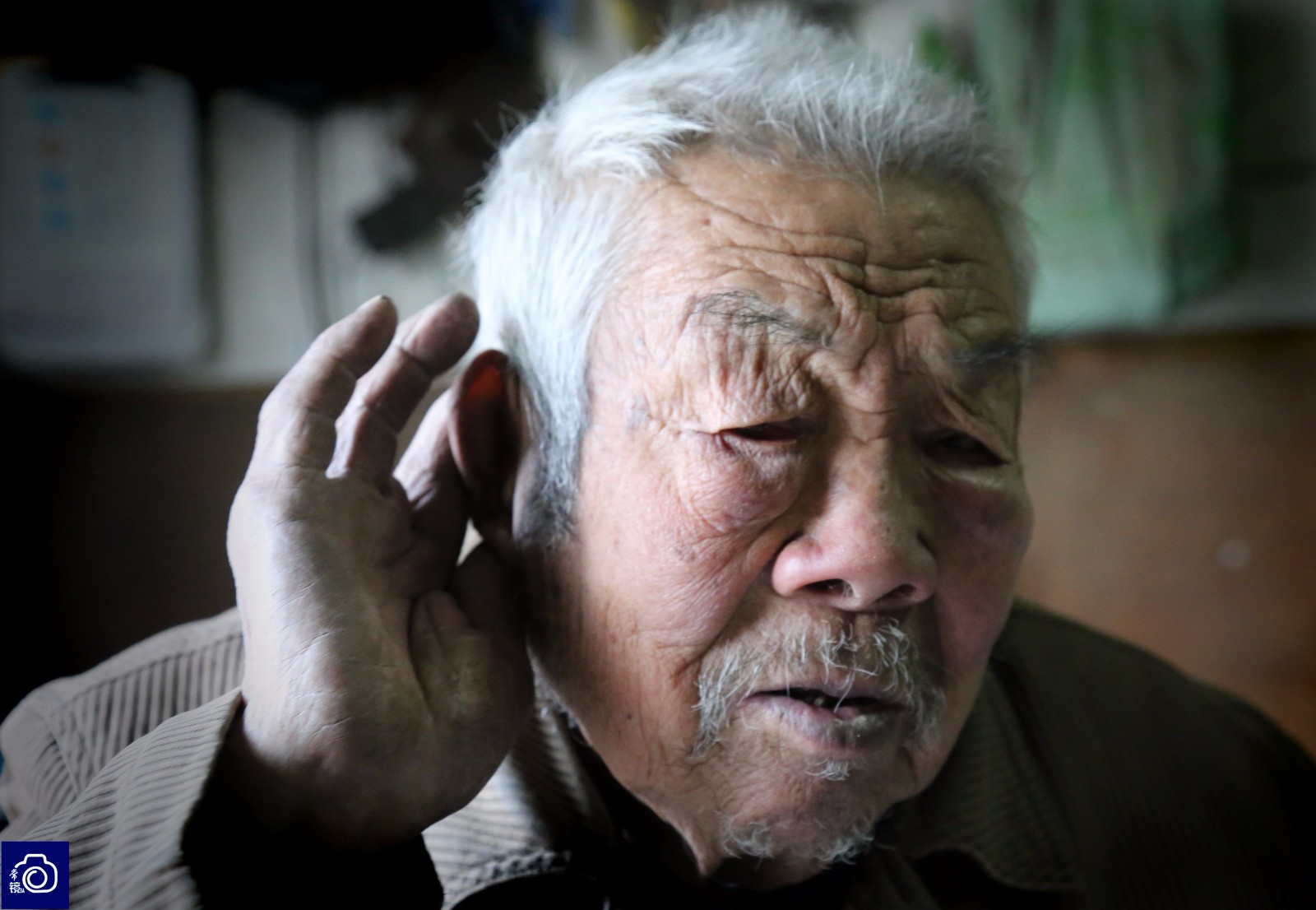 由于多年来眼睛本身就有毛病,再加上十几年前小儿