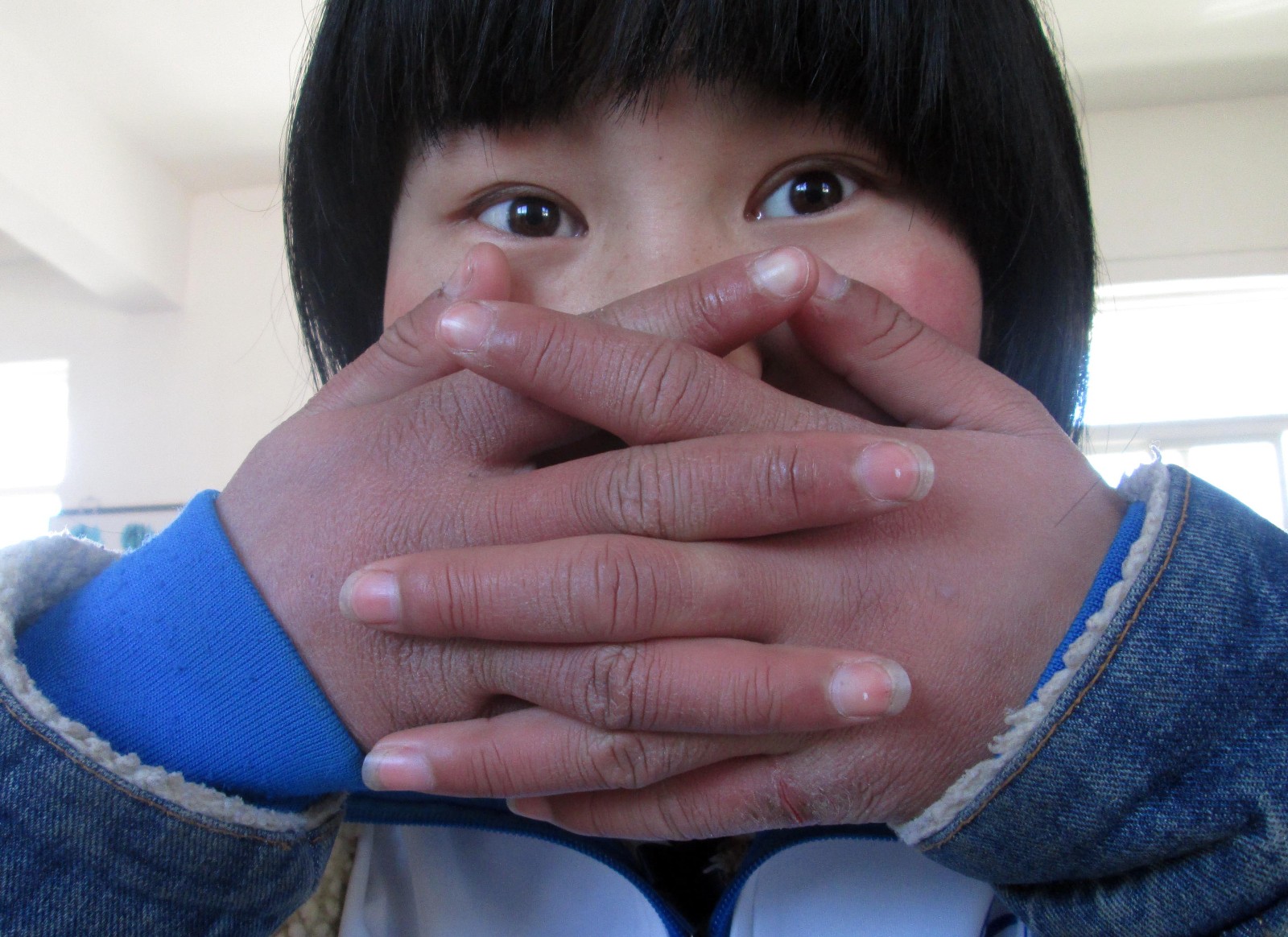 他们的美术老师祝小攀双手也生冻疮了,她说这里条件艰苦.