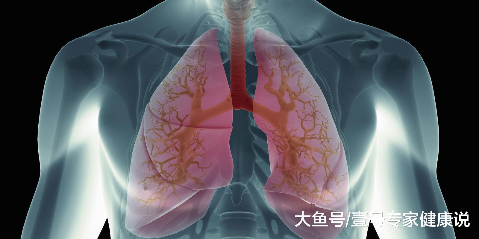 被传染了肺结核却不知道? 注意这5个小信号!