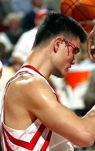 nba赛场上飙血的球星们,纳什浴血赛场,科比乔丹鼻子大出血