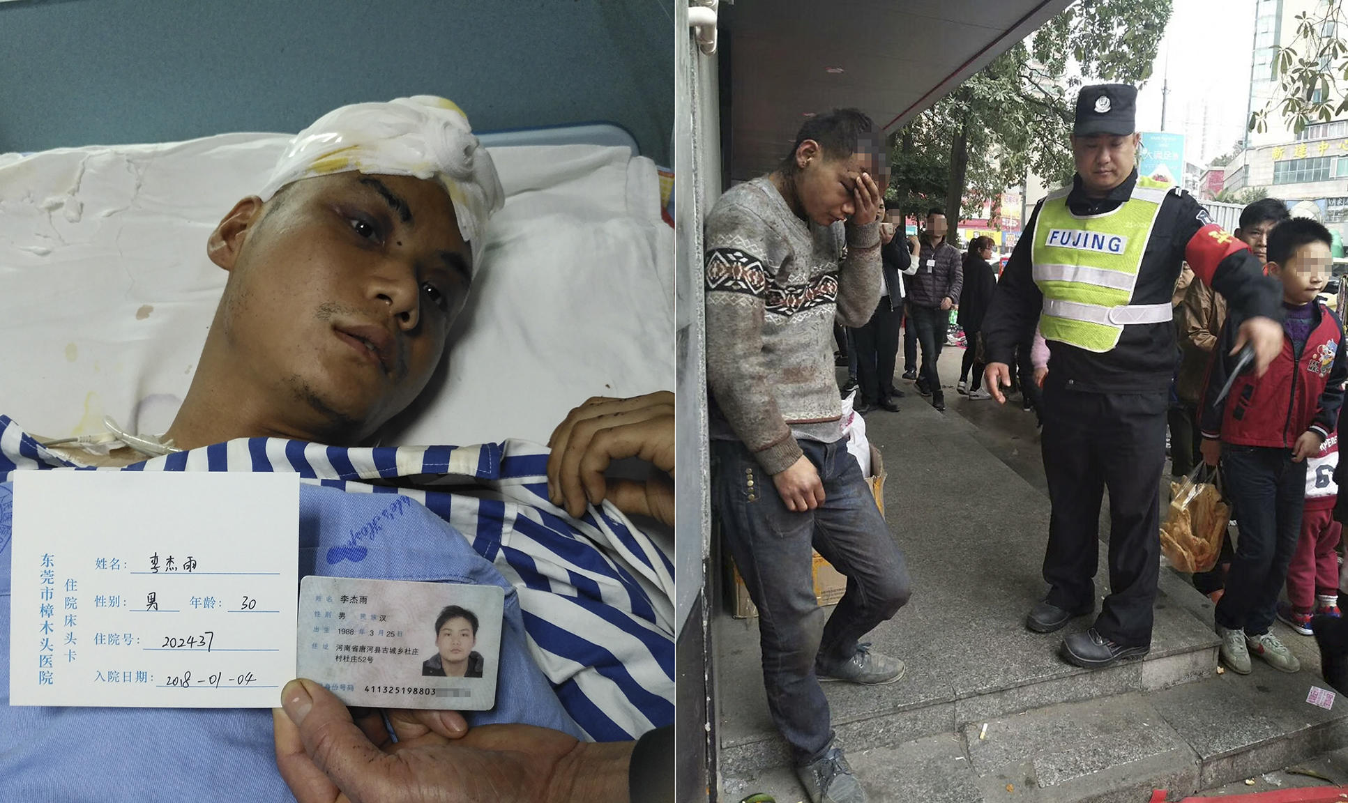 男子在东莞被爆头 醒后失忆真相成谜