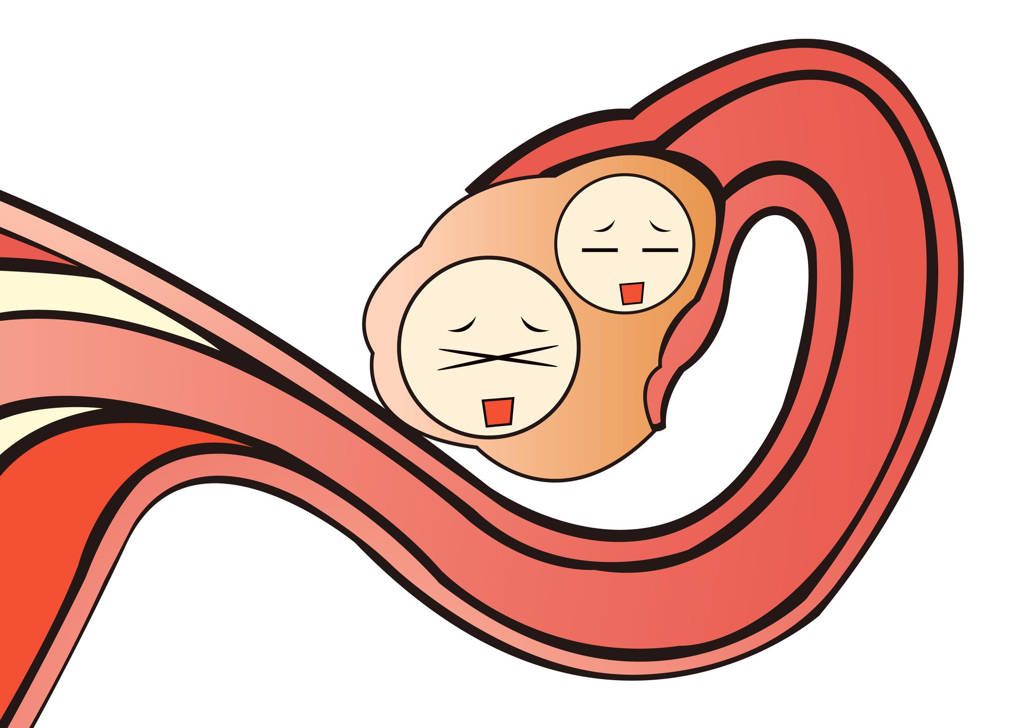 卵泡长不大以及长大了不排,是为什么呢?