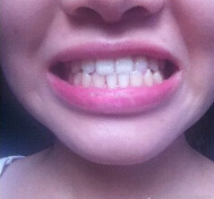 也叫兜齿.上排牙齿代表着天,下排牙齿代表着地,此乃"天地一合"之说.