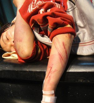 写个作业写不完11岁女孩被打到遍体鳞伤而猝死妈妈失声痛哭