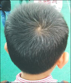 白头发这么多,可能是因为你身体内可能缺了这些东西|要素|少白头|疾病