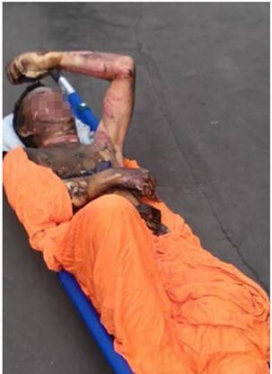 一次误入带电间隔造成人身事故