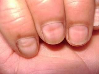 肾不好时,手指甲和眼睛会发出哪些"求救信号"?|手指甲|肾脏|眼睛_新浪