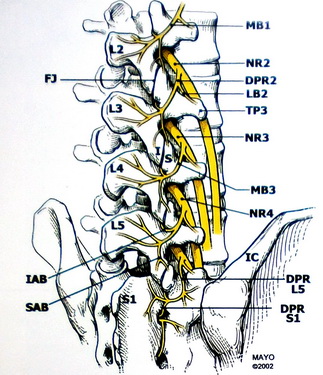 健康讲座:什么是腰间盘突出?应该如何治疗才能一招见效