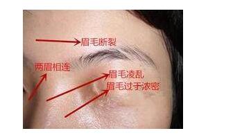 "福薄,命苦,克夫"的面相注定一辈子贫穷难富!凄苦一世