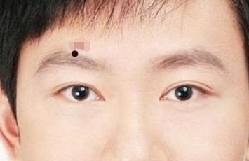 这几处长痣的男人注定旺妻一生好运,你有几颗