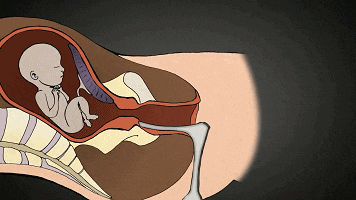 堕胎时胎儿是怎样一步步被杀死的? 心软的妈妈请慎入!