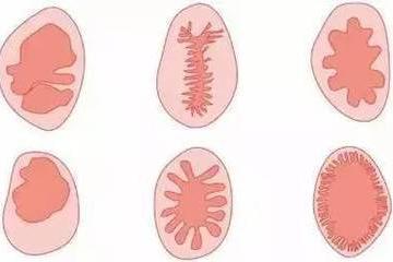 未婚女子体检致处女膜破裂体检医生称是意外网友惊呼