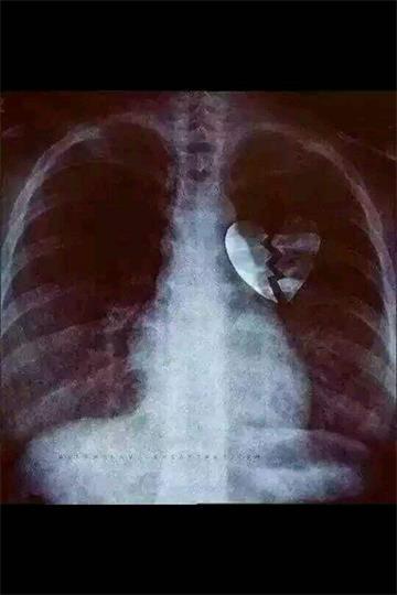 心脏x光图片搞笑图片