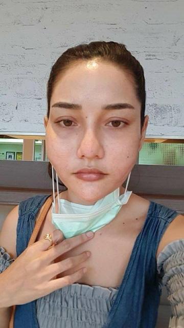 泰国丑女从16岁开始整容,整容后变成漂亮女模,被无数男生倒追!