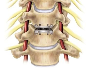 腰不好的人,只要牢记这几点,以后就不用怕腰突了,快收藏吧