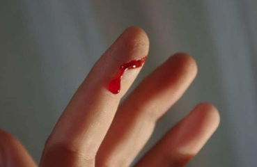 意外创伤时,伤口为什么不能碰水?