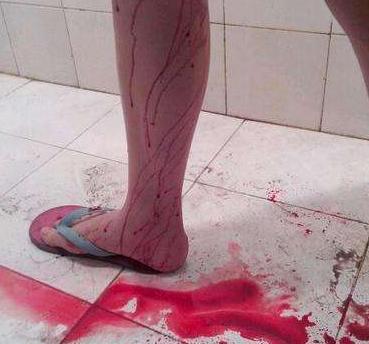 意外流产婆婆请两个小时的假来看我,拿来的东西我从楼上扔了下去