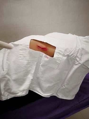 男子头部以及手臂皆被划伤伤口很明显