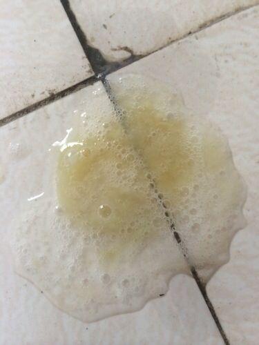 这3类人有痰一定要咳出来否则就是在找病