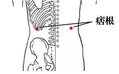 治疗闪腰,慢性腰痛有特效的穴位——"上仙点"