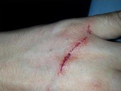 网友养猫半年满手伤痕累累朋友几次劝赶紧丢掉这畜牲