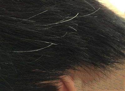 白头发的位置不同说明身体状况也不同看看你的长在哪里