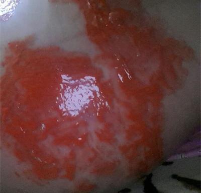 婆婆, 我大肚子烫成这样, 你宁愿在家打麻将, 也不肯给我做顿饭?