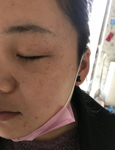 为什么别人的肌肤这么白嫰原来是用几毛钱的它皱纹又祛斑