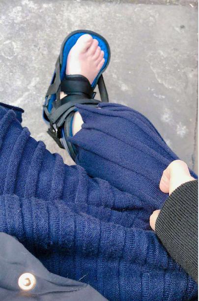 冯提莫因伤停播晒骨折照网友佩服这样也能受伤