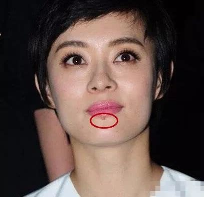 这10位明星脸上都有疤,郑爽被怀疑整容,杨幂自拍只爱拍半边脸!