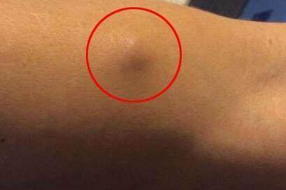 央视主持人朱迅患癌,身体出现这6种症状,说明体内有癌细胞|朱迅|癌症