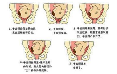 开骨缝开到十指,是真的骨头裂开十个手指头吗?9成孕妈搞错了