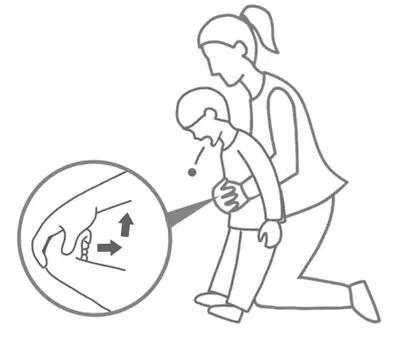 这个技能必须学会, 关键时刻能救命|腹部|异物|急救法_新浪新闻