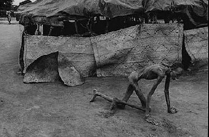 直击:非洲那些骨瘦如柴的孩子们,直刺人心!