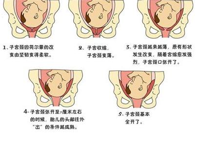 宫口开十指有多大图片